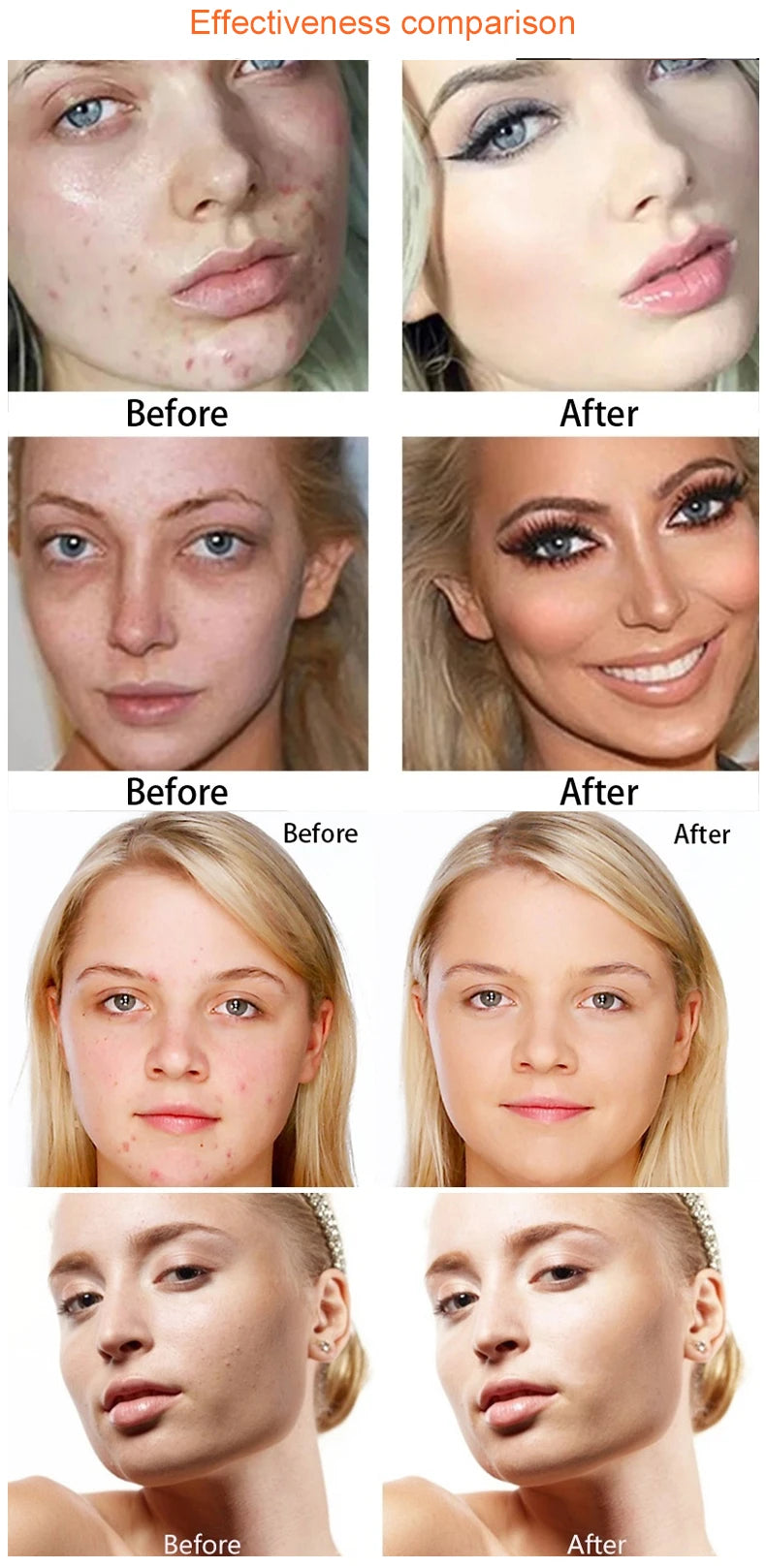 15 Colors Face Concealer Camouflage Cream Contour Palette Maquillaje Profesional Foundation Paleta Concealer